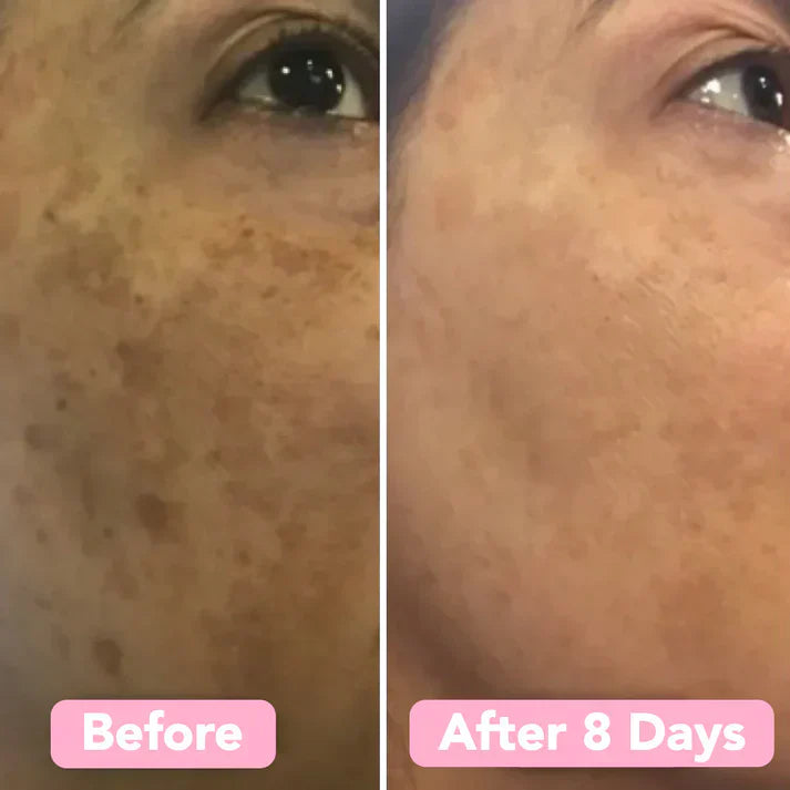 LuméaSkin™ Kurkuma kojic pads