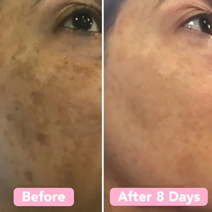 LuméaSkin™  Kurkuma kojic pads