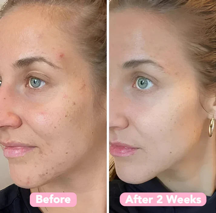 LuméaSkin™  Kurkuma kojic pads